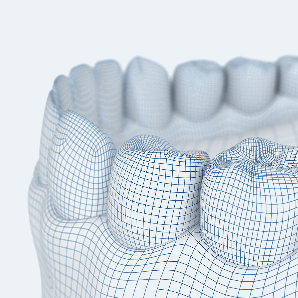 scansione per ortodonzia | La clinica dentale