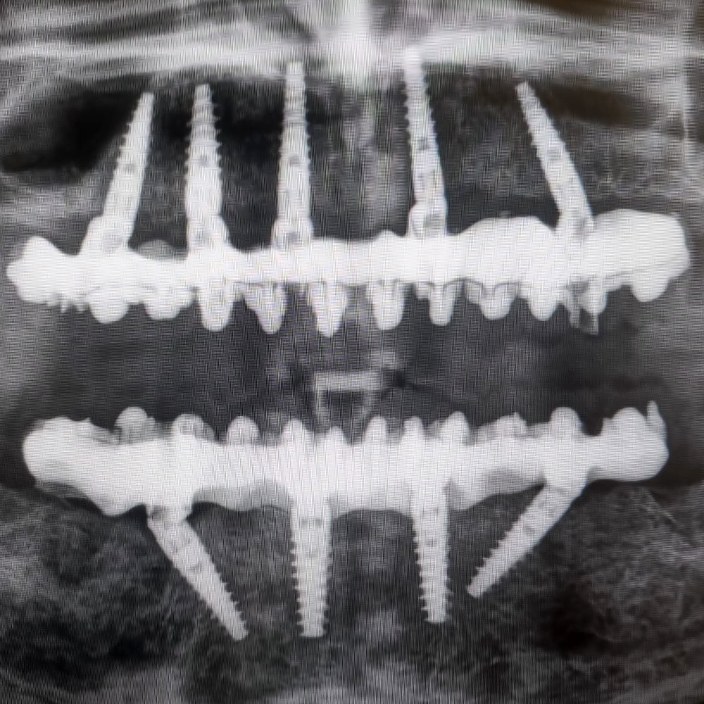 ortopantomiografia | La clinica dentale