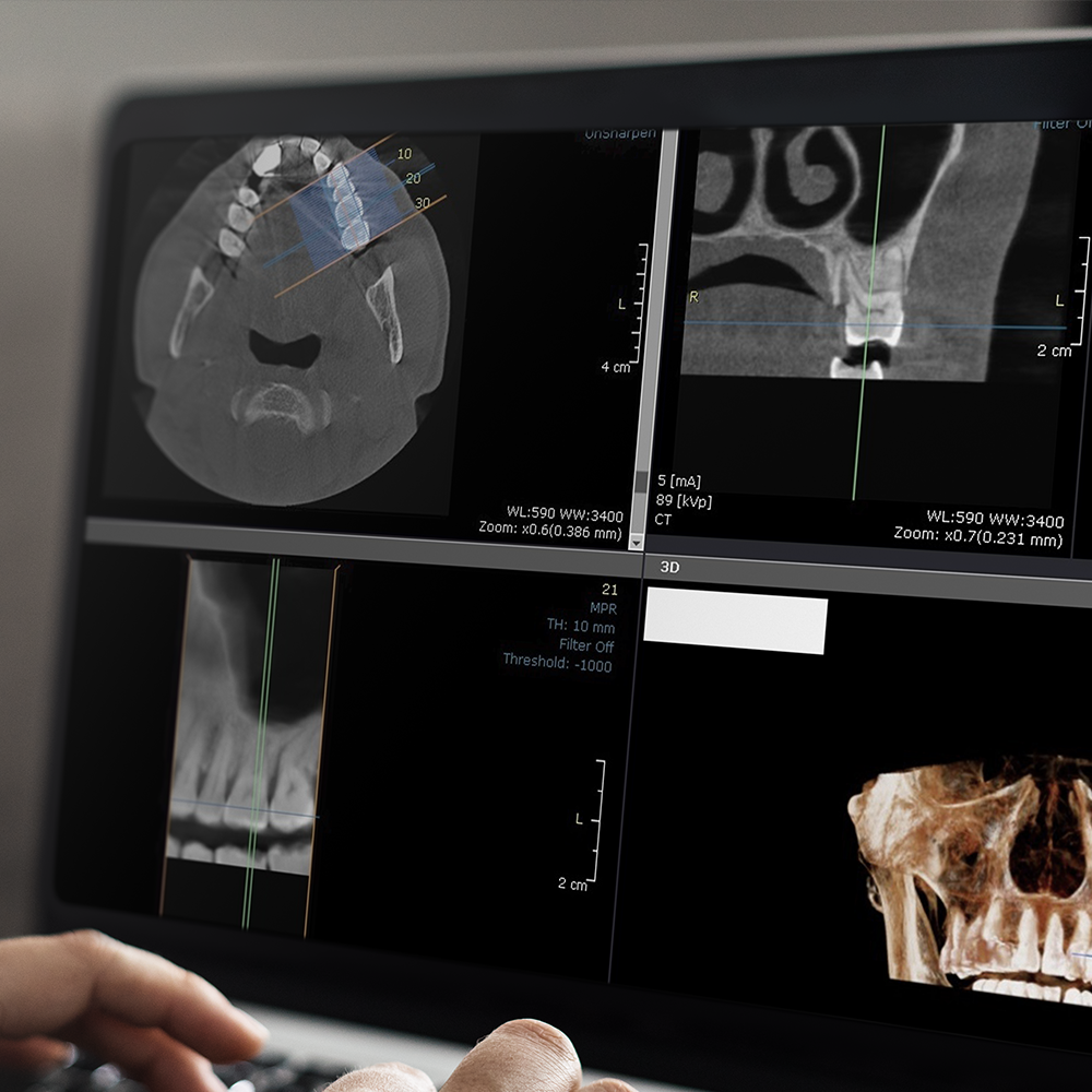 radiologia tac 3d | La clinica dentale
