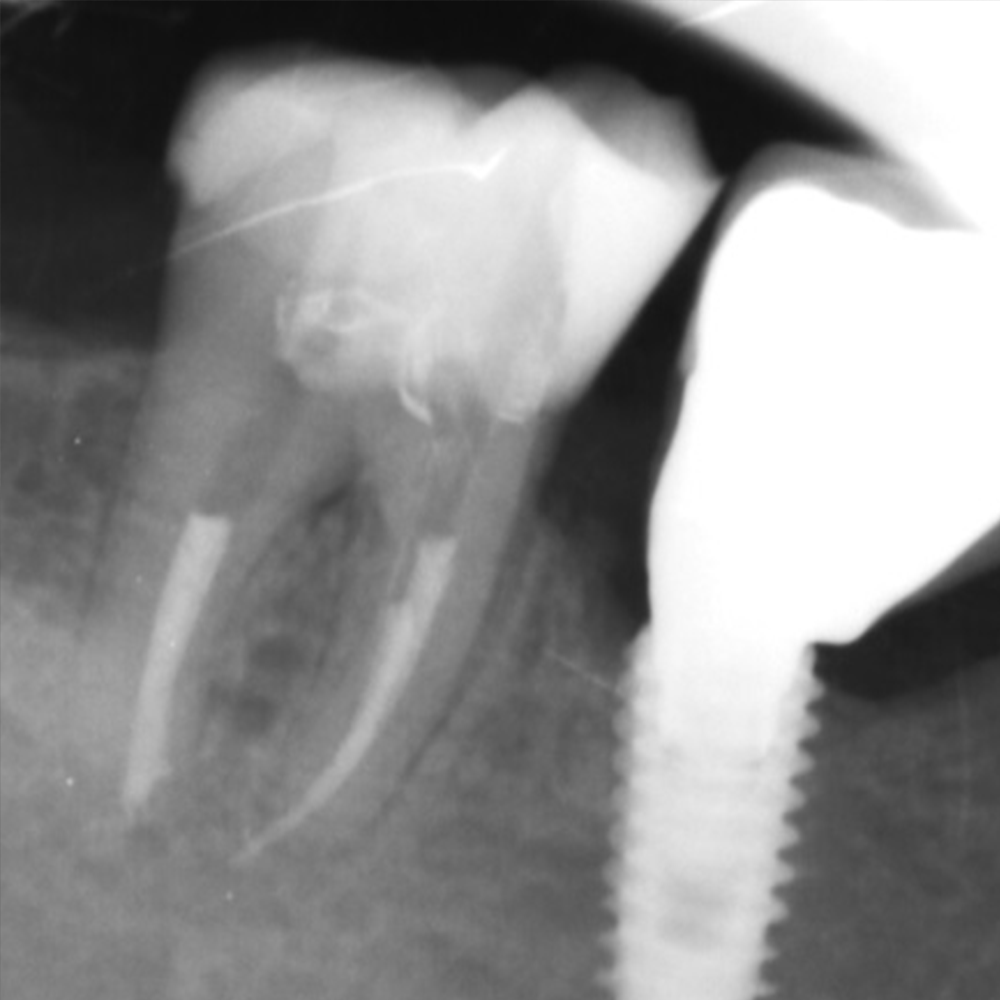 rafiografia fatta dalla clinica dentale